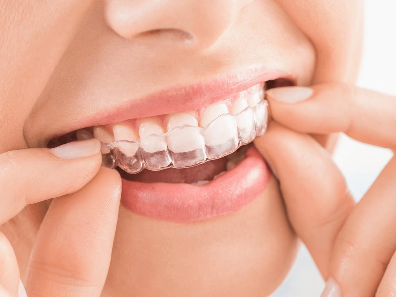 invisalign provider santa engracia